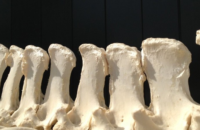 Kissin spines